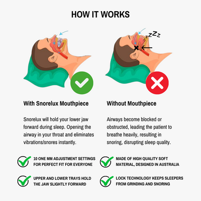 Anti-Snoring Mandibular Device